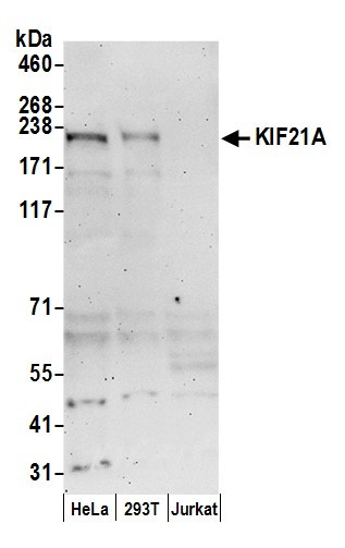 Anti-KIF21A