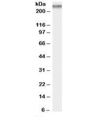 Anti-COL7A1