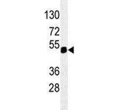Anti-PAX6, clone 193CT15.2.2