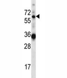 Anti-GATAD2B