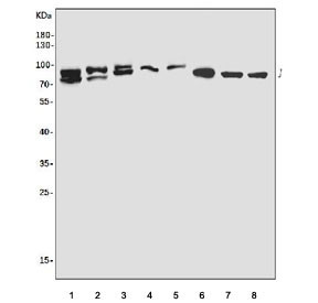 Anti-ABIN-1 / TNIP1