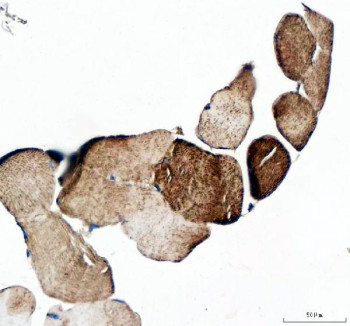 Anti-MYOT / Myotilin