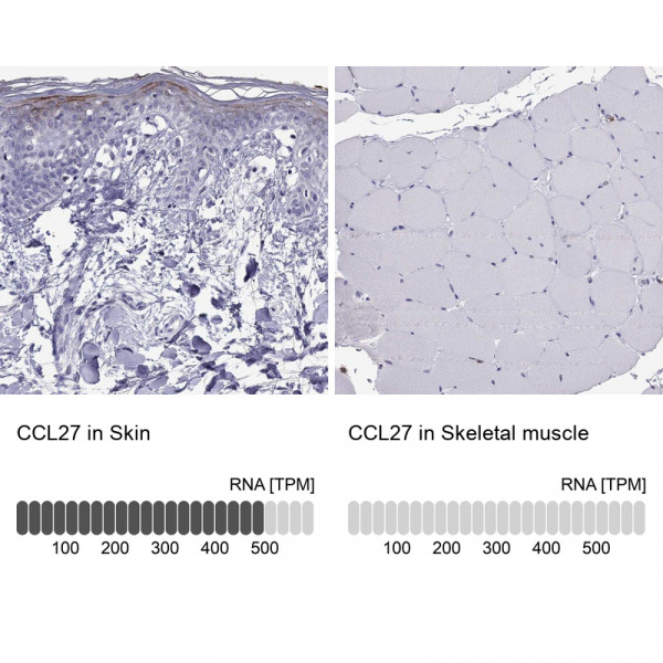 Anti-CCL27