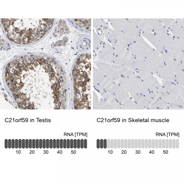 Anti-C21orf59