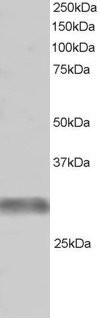 Anti-GNIP / TRIM7, C-terminal