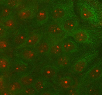 Anti-RAD51D / RAD51 homolog D