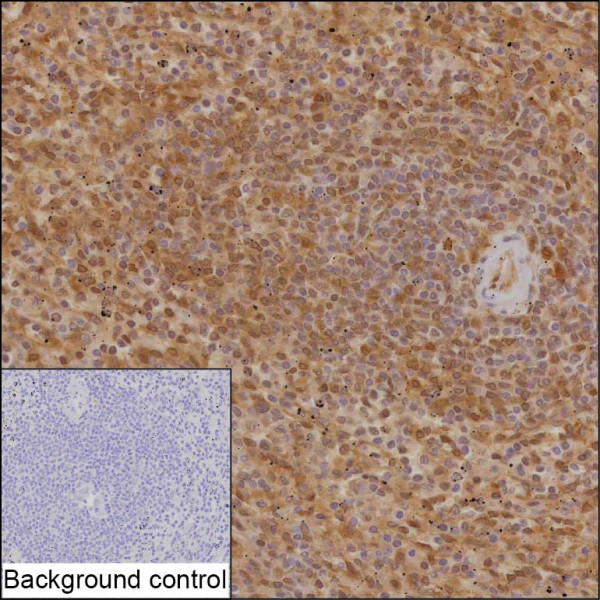 Anti-Proteasome beta 9