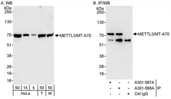 Anti-METTL3/MT-A70