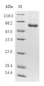 Thymidylate kinase (DTYMK), human, recombinant