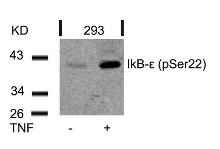 Anti-Phospho-NFKBIE (Ser22)