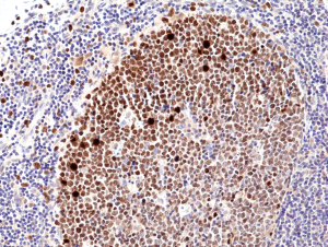 Anti-KI67 (human), Rabbit Monoclonal (RM360)