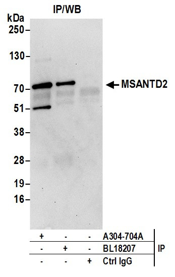 Anti-MSANTD2