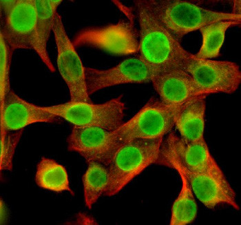 Anti-NEK5 / NimA-related protein kinase 5