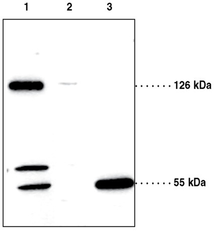 Anti-SREBP-2