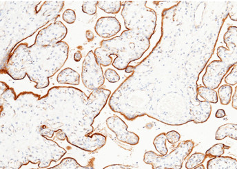 Anti-LIFR/CD118 Monoclonal Recombinant Antibody