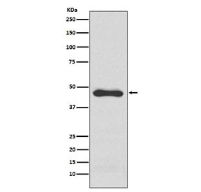 Anti-PAI-1, clone ABHG-19