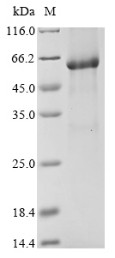 Bifunctional 3'-5' exonuclease/ATP-dependent helicase WRN (WRN), partial, human, recombinant