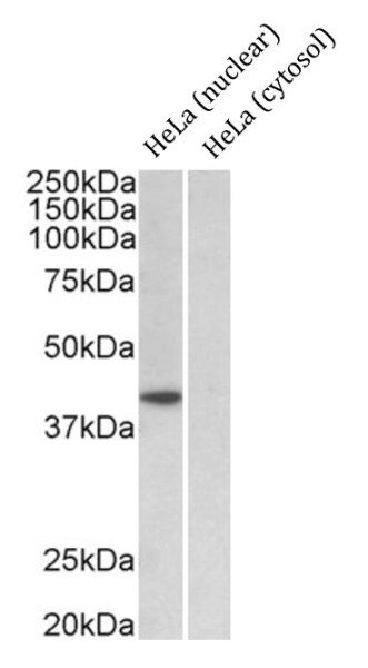 Anti-TBP / TATA Binding Protein