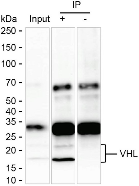 Anti-VHL (recombinant antibody)