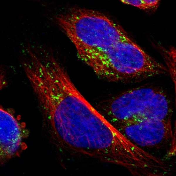 Anti-ATP6V1B2