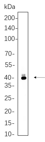 Anti-Recombinant PAX5, clone 2D4
