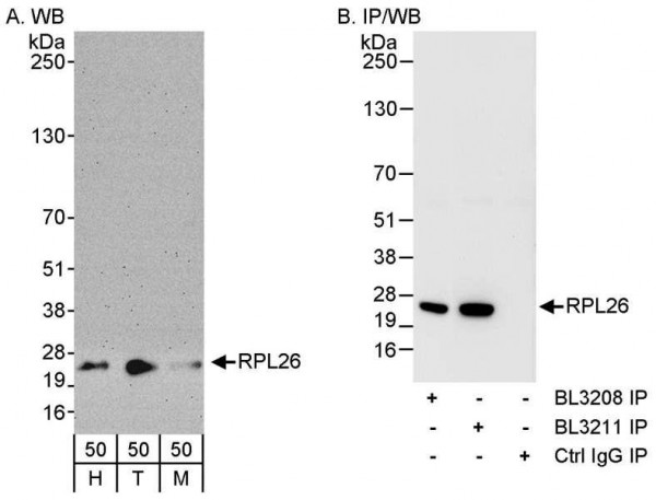 Anti-RPL26