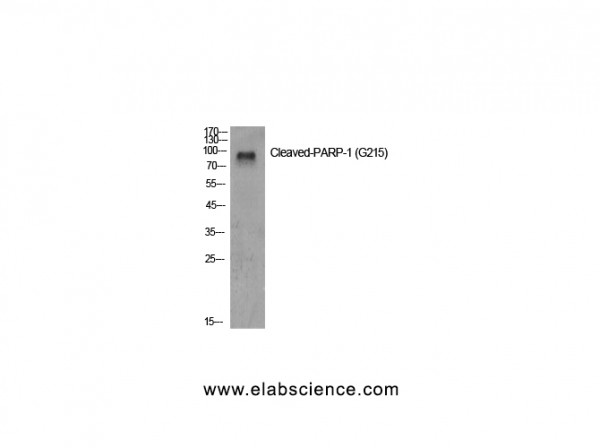 Anti-Cleaved-PARP-1 (G215)