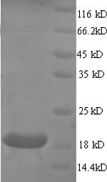 Myosin regulatory light chain 2, ventricular/cardiac muscle isoform (MYL2),partial, human, recombina