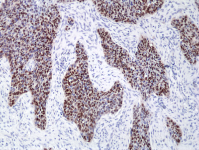 Anti-SOX2 (human), Rabbit Monoclonal (RM427)