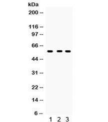 Anti-CYP27B1
