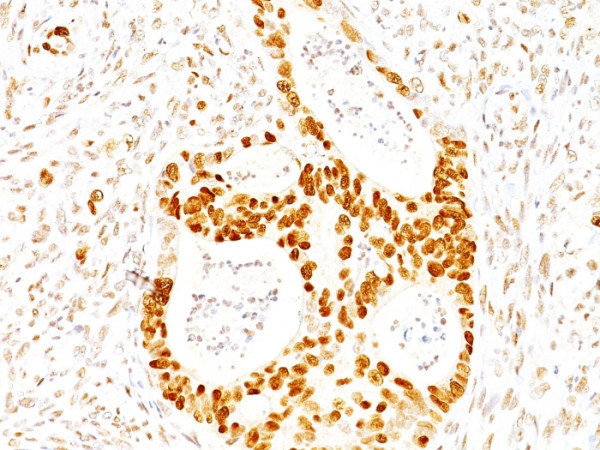 Anti-p27Kip1 (Mitotic Inhibitor/Suppressor Protein), clone SX53G8