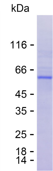 Recombinant Human THBS3 Protein