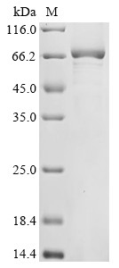 Ribonuclease ZC3H12A (ZC3H12A), human, recombinant