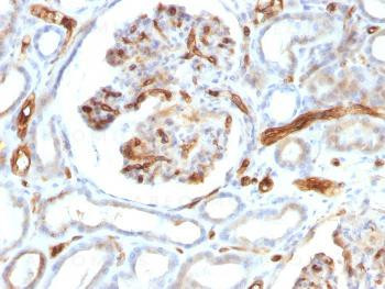 Anti-Adiponectin (Marker of Obesity) Monoclonal Antibody (Clone: ADPN/1370)