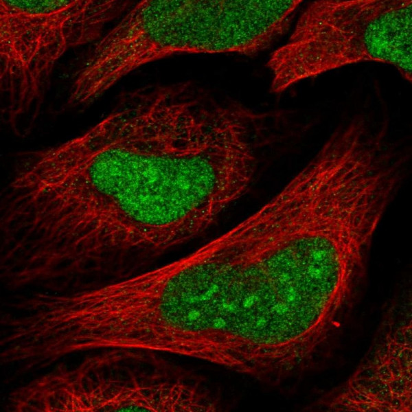 Anti-TSPYL1