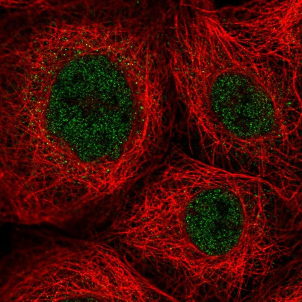 Anti-ZNF22