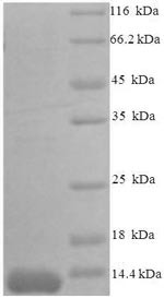 C-C motif chemokine 7 (Ccl7), partial, mouse, recombinant
