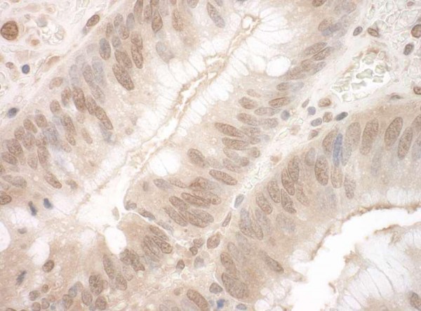 Anti-EYA3 (IHC)