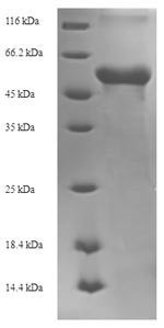 Matrix protein VP40 (VP40), Zaire ebolavirus, recombinant