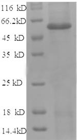Angiopoietin-2 (ANGPT2), partial, human, recombinant