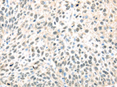 Anti-TCEB1