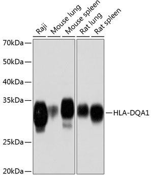 Anti-HLA-DQA1
