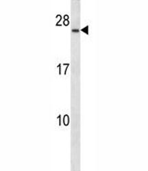 Anti-CD79a Antibody