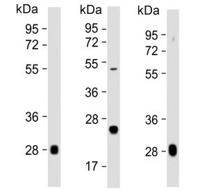 Anti-Complement Factor D / CFD