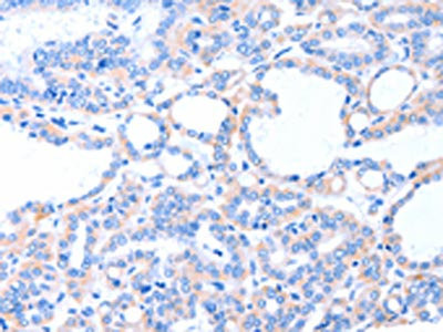 Anti-ACAD8