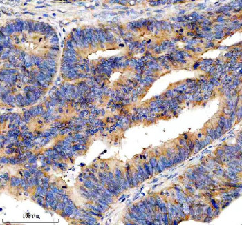 Anti-EIF3H / Eukaryotic translation initiation factor 3 subunit H