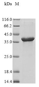 Non-structural maintenance of chromosomes element 3 homolog (NSMCE3), human, recombinant