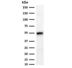 Anti-KRT15 / Cytokeratin 15, clone CTKN15-1