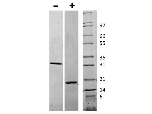 Macrophage Colony Stimulating Factor