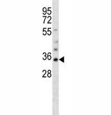 Anti-Olig1